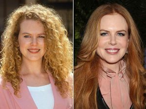 nicole kidman chirurgie esthetique avant apres nicole kidman chirurgie esthetique avant apres
