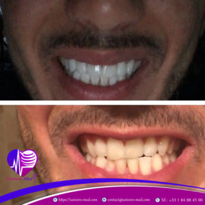 chirurgie esthetique homme