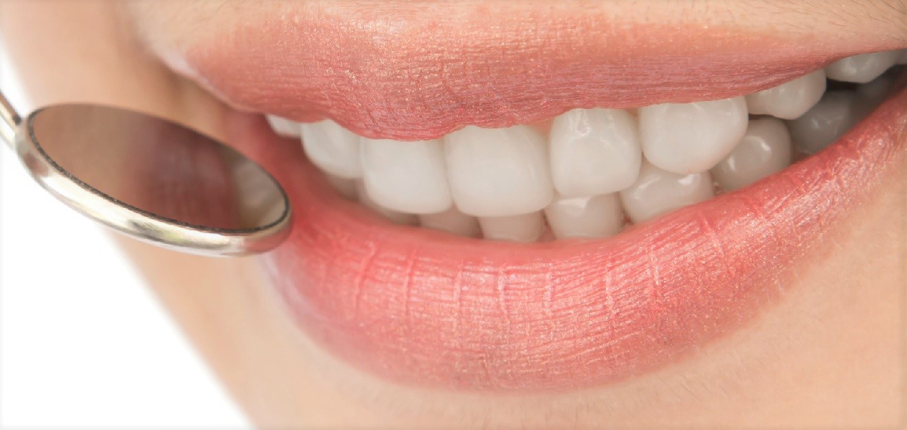 dental implants costs