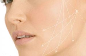 Fils tenseurs visage Fils tenseurs visage